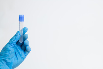 Vacuum tube for collection and blood samples with sodium citrate in blue gloves for laboratory. On...