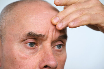 close-up of mature man, senior 60 years old looks carefully examines wrinkles around eyes, skin...