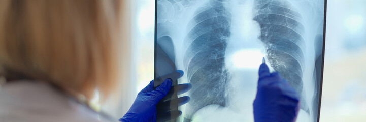 Woman doctor holding x-ray of lungs in hospital