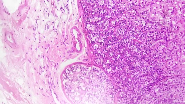 Adrenal gland of human being in section filmed under microscope 200x times magnification. Macro view of man organ showing different layers of cells. Producing steroid hormones concept. Medicine theme.