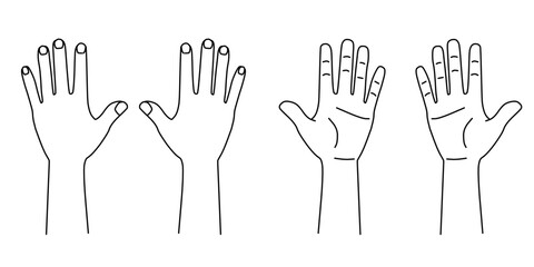 手の平手の甲両手のイラスト線画｜カルテなどの診療記録に使える