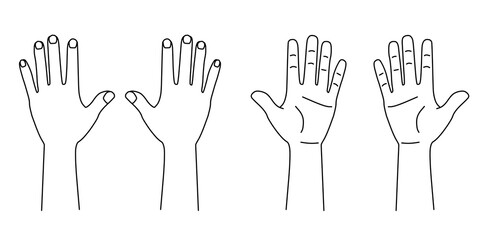 手の平手の甲両手のイラスト線画｜カルテなどの診療記録に使える