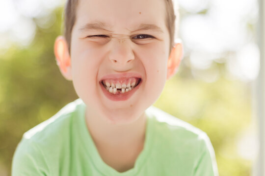 Cute boy showing gap tooth
