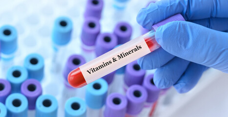 Doctor holding a test blood sample tube with Vitamins and Minerals test on the background of...