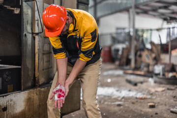 Industrial technician had his hand caught by a piece of machinery. Accidental machine crushing occurred during routinely scheduled maintenance. Bandages as starting treatment before hospitalization.