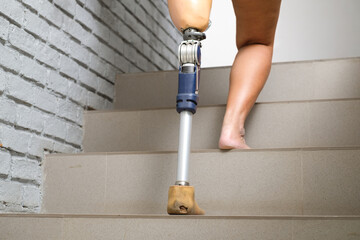 Asian woman with prosthetic legs walks up the stairs of her home to go to bed and rest.