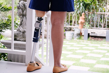 Disabled woman with bionic legs.