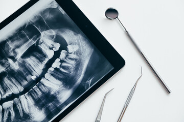 Dental instruments and jaw x-ray on white table. Panoramic digital jaw x-ray on tablet, white background.