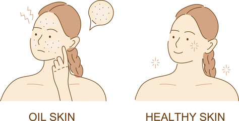 Acne skin with black dots. Face with pimples, acne. Teenager skin. The girl worries about unhealthy skin of her face. Skincare and dermatology.