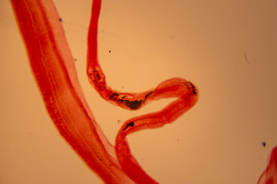 photo of human parasite worms under the microscope