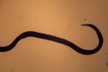 photo of human parasite worms under the microscope