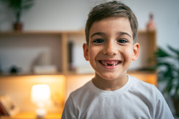 Boy without milk upper tooth in white t-shirt smile with hole in mouth