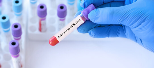 Doctor holding a test blood sample tube with Astrovirus PCR test on the background of medical test tubes with analyzes.