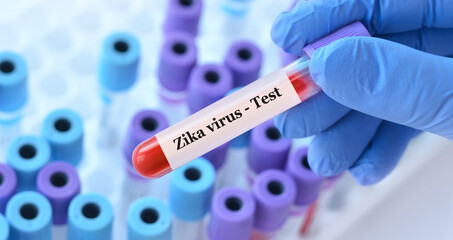 Doctor holding a test blood sample tube with Zika virus test on the background of medical test...