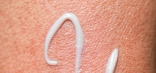 Close up of Sunscreen Protection or Sun Cream on human skin. Skin and Body Care. SPF Lotion or...