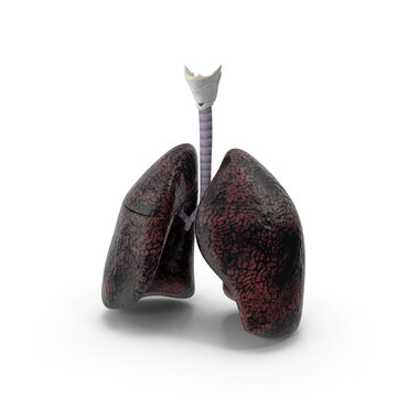 Smokers lungs stage heavy