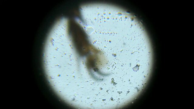 House Fly leg, magnified through microscope