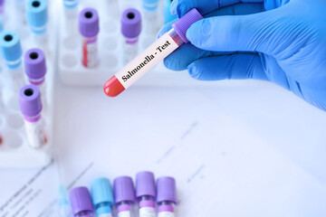 Doctor holding a test blood sample tube with Salmonella test on the background of medical test tubes with analyzes.