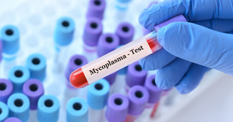 Doctor holding a test blood sample tube with Mycoplasma test on the background of medical test tubes with analyzes.