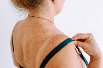 Middle-aged woman, plump, flabby skin with age spots