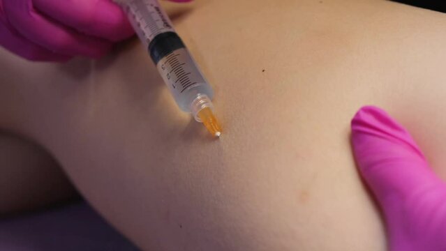 A doctor of aesthetic cosmetology makes lipolytic injections to burn body fat on a woman s on the hips, legs and thighs . Female aesthetic cosmetology in a beauty salon. Close-up.