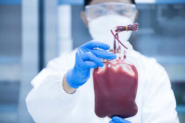 Scientist wear blue gloves hand holding red blood bag from donor at blood bank laboratory.Doctor and fresh blood for transfusion.Save life medical concept.
