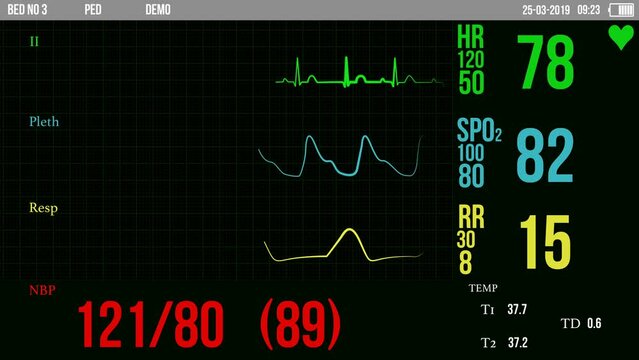 Medical ECG Heart Beat Screen Monitor