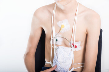 Obraz na płótnie Canvas Teenager on white background with Holter on chest. Heart electrocardiogram or monitoring using Holter for young patient. Healthcare concept
