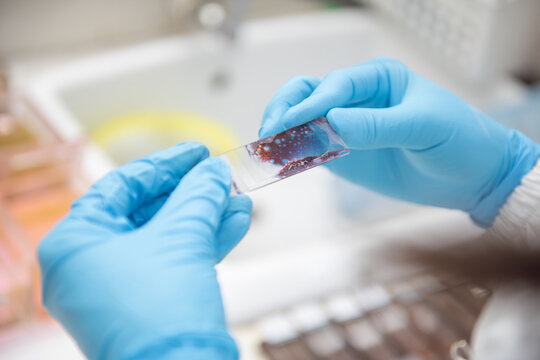 Medical scientists preparing cytology slides for pathologists to diagnose in hospital.