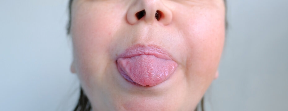close-up of female tongue protruding outward, performs articulation exercises for mouth, concept of speech disorders, correction, frenum of tongue, methods of correctional developmental exercises