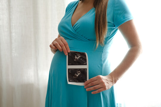 Cheerful pregnant woman with ultrasound scan image posing near window at home. Pregnant woman looking at ultrasound scan of baby