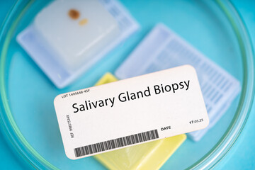 Salivary Gland Biopsy