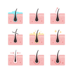 Vector collection of hair, hair loss, skin, pores, skin care illustration icons