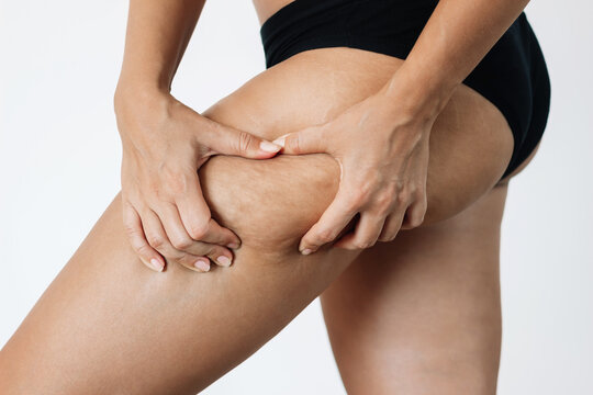 Cropped shot of a young tanned woman in black panties grabbing skin on her thigh with excess fat and cellulite isolated on a white background. Excess weight, overweight. Flabby sagging skin