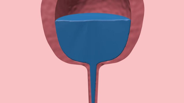 Male healthy and unhealthy prostate, prostate hypertrophy and inflammation isolated on white background