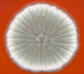 A colony of a common fungus seen at high magnification