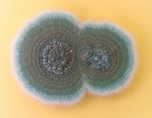 A colony of a common fungus seen at high magnification