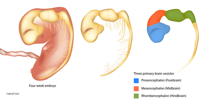Three primary brain vesicles. Four week embryo. Prosencephalon or Forebrain, Mesencephalon or Midbrain, Rhombencephalon or Hindbrain.