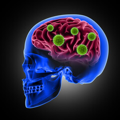 3D render of a male skull with virus cells attacking the brain