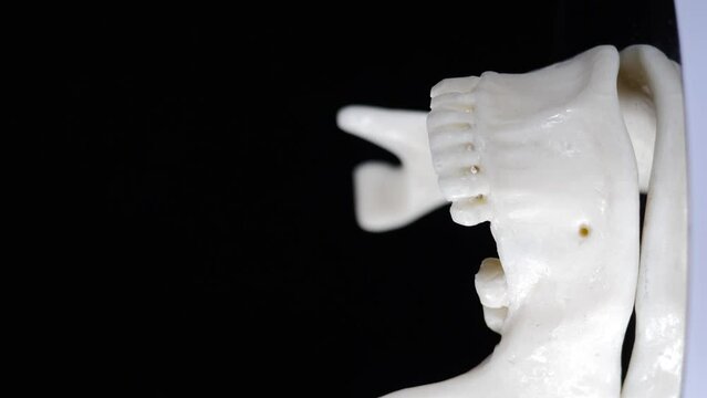 Rotating jaw model of human teeth with implants and placeholder pins. Vertical footage. Black background. Missing teeth replacement. Dental implant installation. Jaw with premolar dental implant