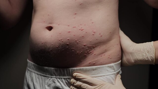 Examination at a specialist's, allergic reaction, numerous pimples observed. Possible insect bites. Intense itching.