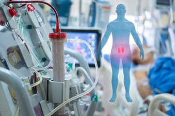 Experts are preparing a dialysis machine for use in critically ill patients in hospital intensive...