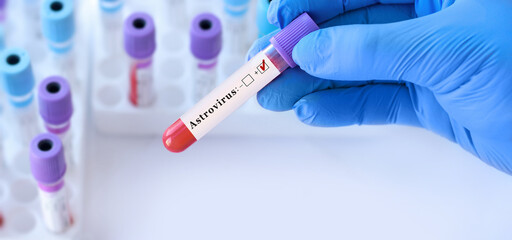 Doctor holding a test blood sample tube with Astrovirus PCR test on the background of medical test tubes with analyzes.