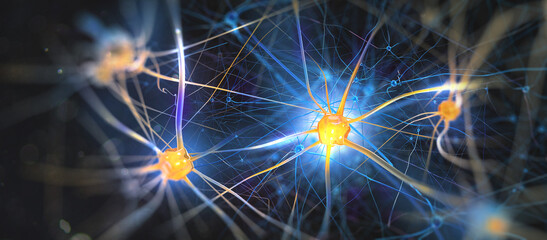 Neurons damaged by Alzheimer's disease (3d illustration)