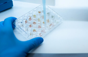 cell culture at the medicine  medical and cell culture laboratory  bioengineering 