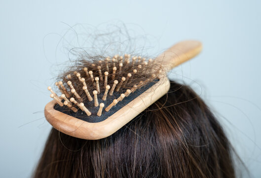 A Comb With Messy Hair Place On Woman Head. Hair Loss It Cause From Family History, Hormonal Changes, Unhealthy Of Aging.