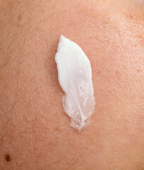 white cream on a person's skin 