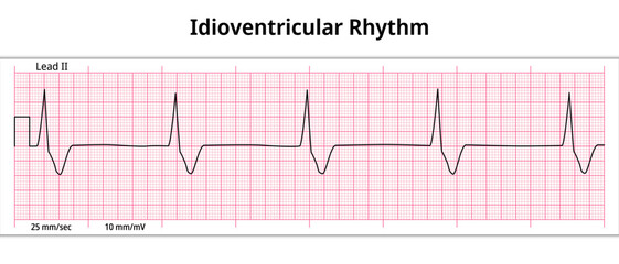 ECG Idioventricular Rhythm - 8 Second ECG Paper - Electrocardiography Medical Vector Illustration