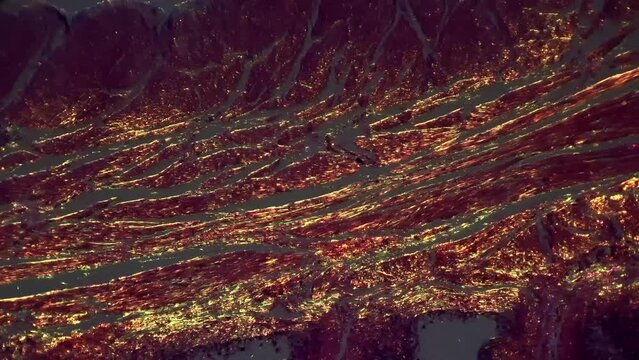Human bladder in section void filmed under microscope 100x with oblique illumination. Studying urine system of people using professional scientific equipment. Medical check to find inflammation