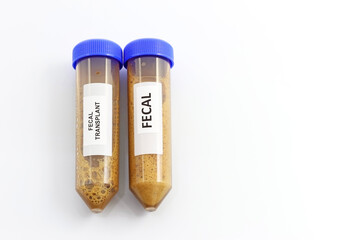 Fecal transplant or fecal matter transplant (FMT). Laboratory tubes with with fecal microorganisms...